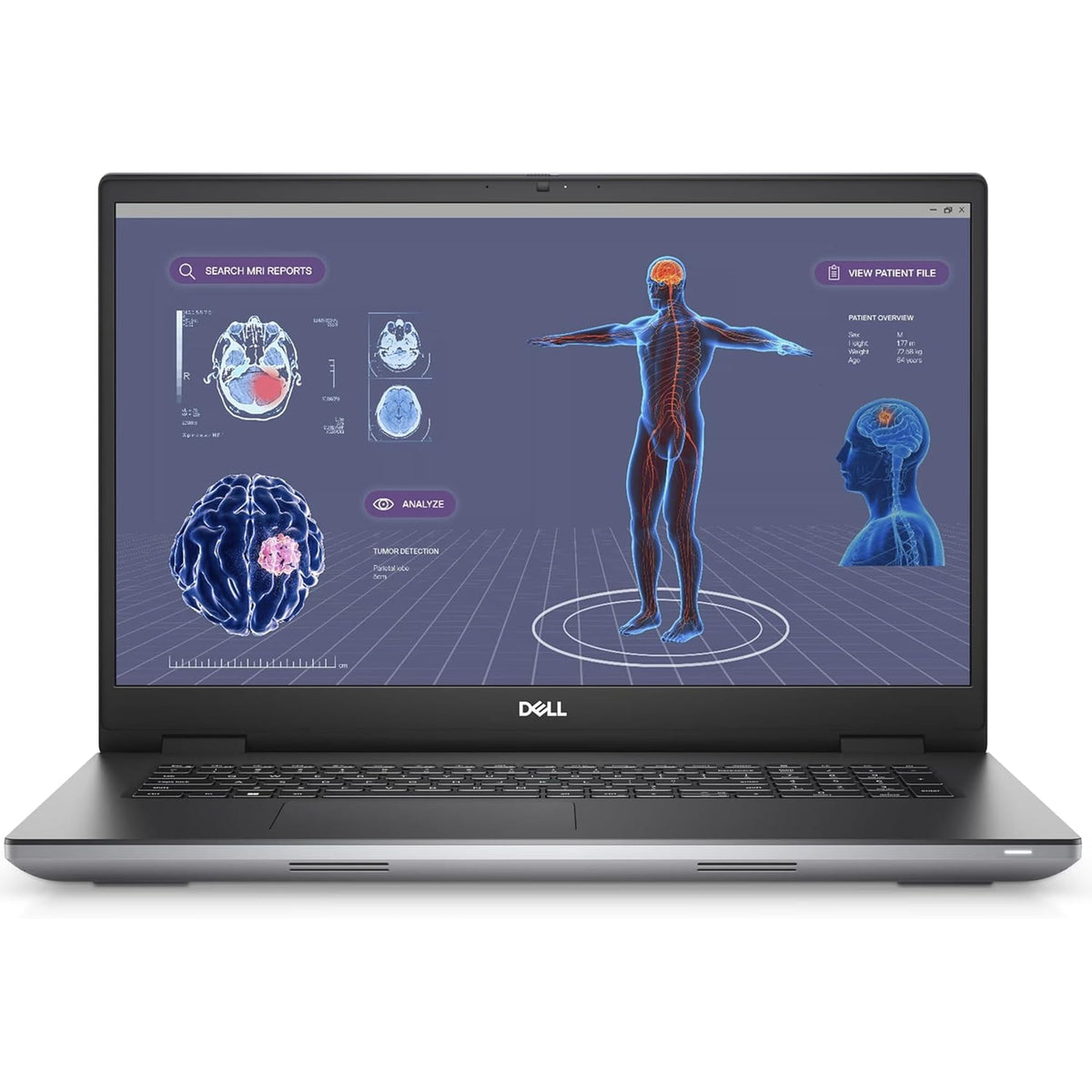 Dell Precision 7680 16" FHD+ Laptop - i5-13600HX, RTX 2000 ADA (Refurbished - Excellent)