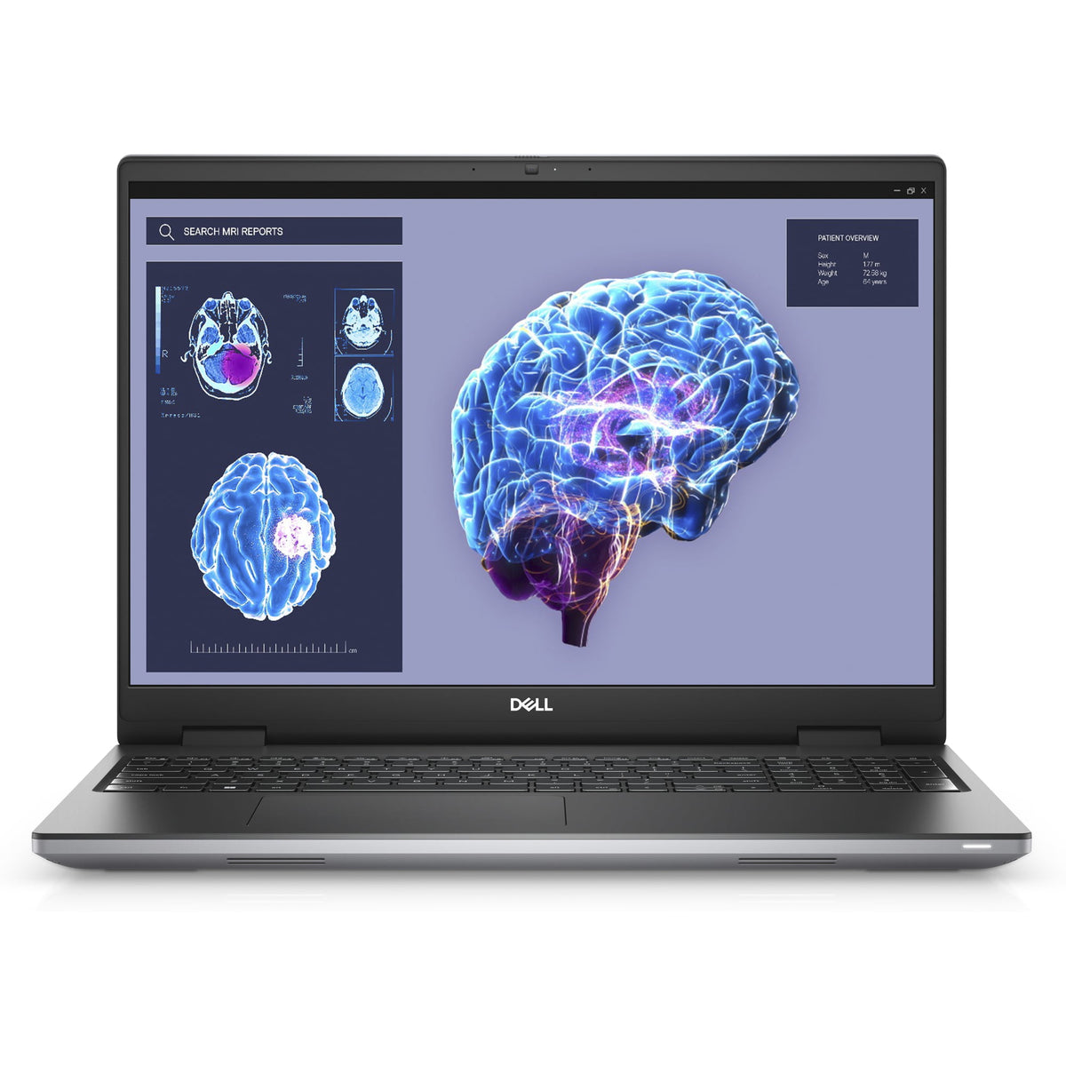 Dell Precision 7680 16" FHD+ i7-13850HX, 64GB, RTX 3500 ADA (Refurbished - Excellent)