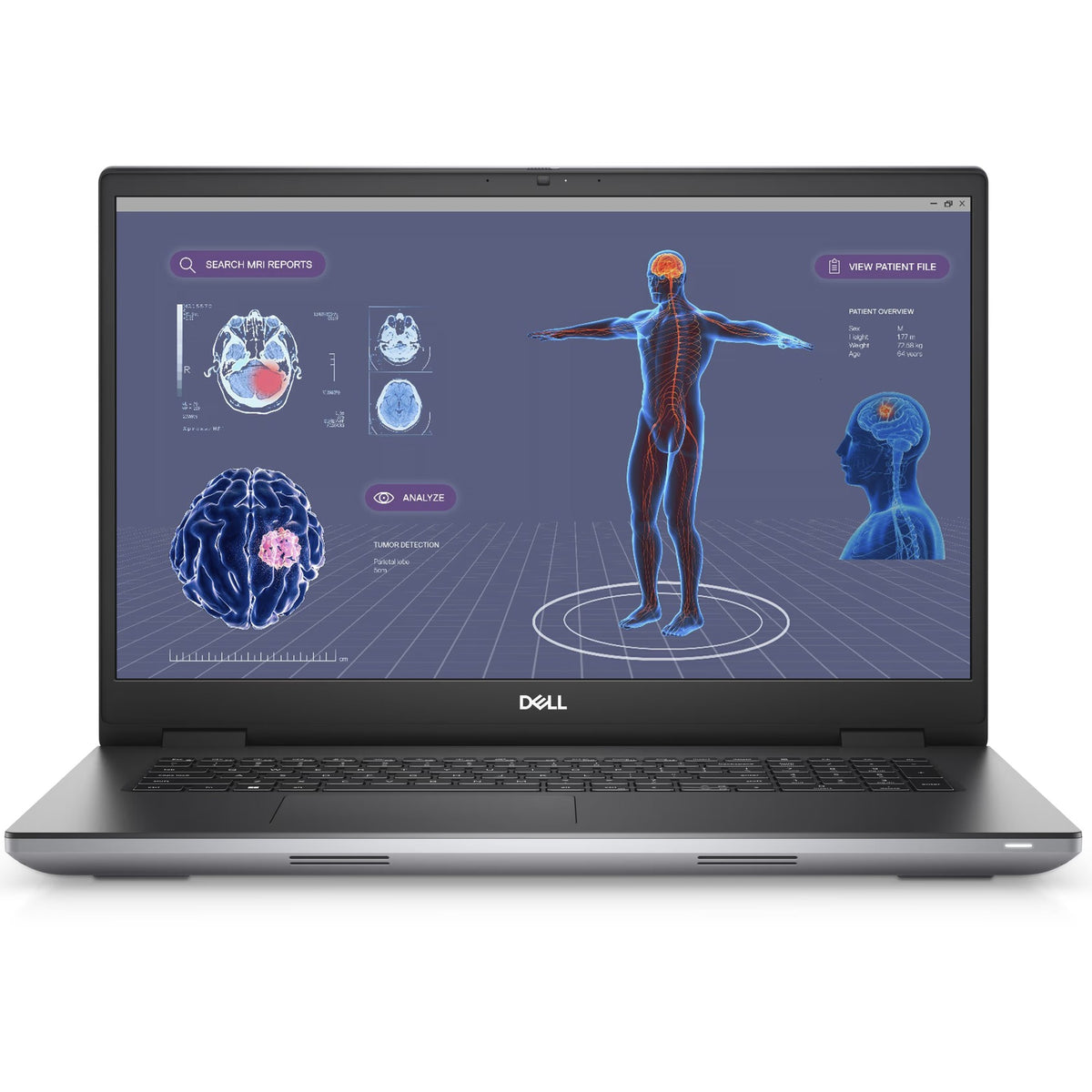 Dell Precision 7780 17.3" FHD - i7-13850HX, 64GB, RTX 3500 ADA (Refurbished - Good)